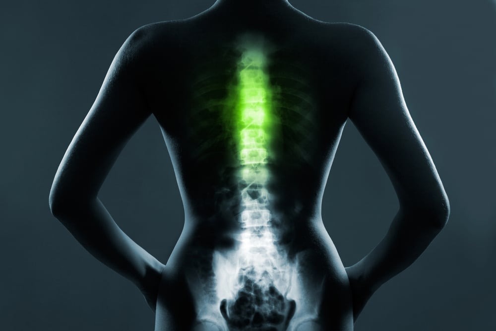 a graphic image of backbone